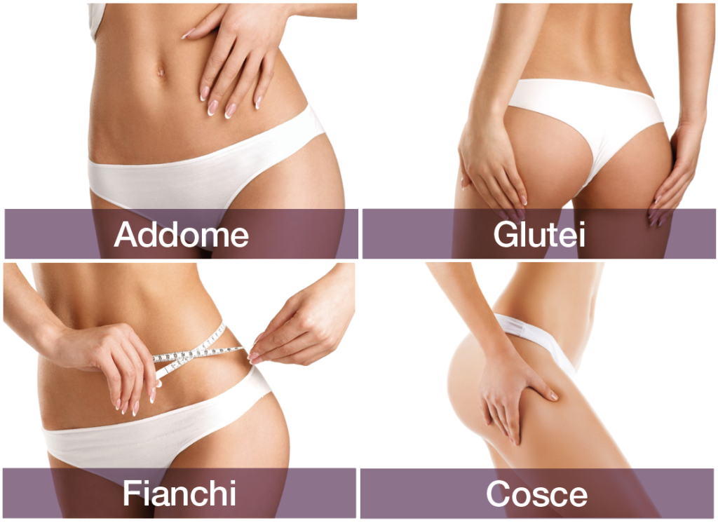 zone trattate del corpo con l'hifu